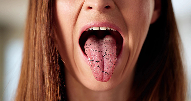 Jazyk je zrcadlem zdraví. Pozor na barvu, povlak i změnu tvaru