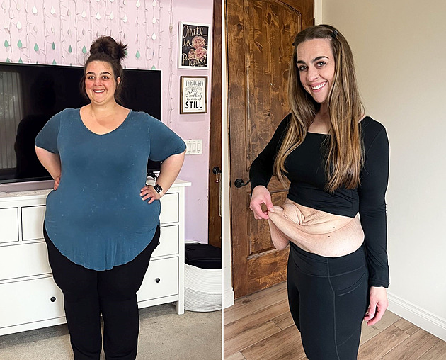 Žena zhubla devadesát kilo, k dokonalosti to ale nestačilo