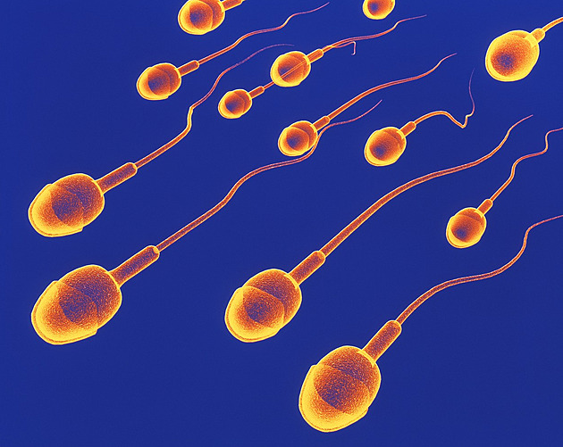 V kraji je nízká porodnost, příčinu může pomoci odhalit i vyšetření spermatu